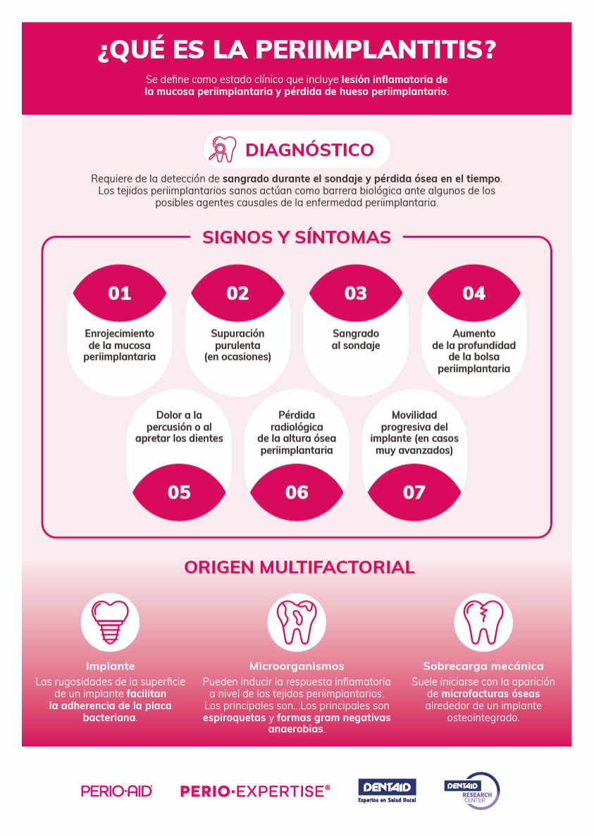 ¿Qué es la periimplantitis?